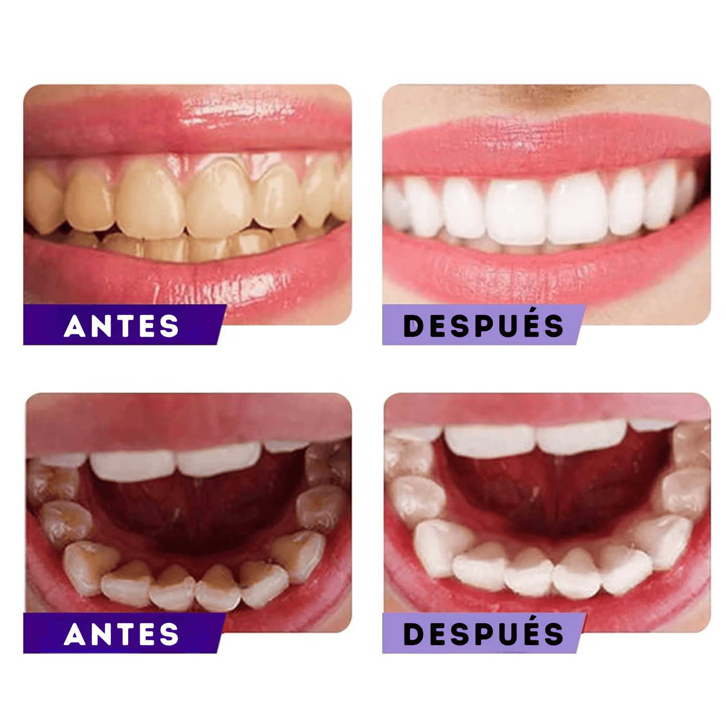 😲CORRECTOR DE COLOR DENTAL😍