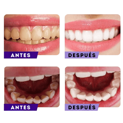 😲CORRECTOR DE COLOR DENTAL😍